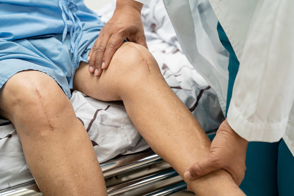 A doctor inspecting a patient whose knees have been replaced.