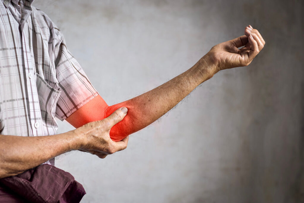 A man holding his elbow in pain.